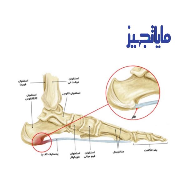 کفی خارپاشنه پنجه دار